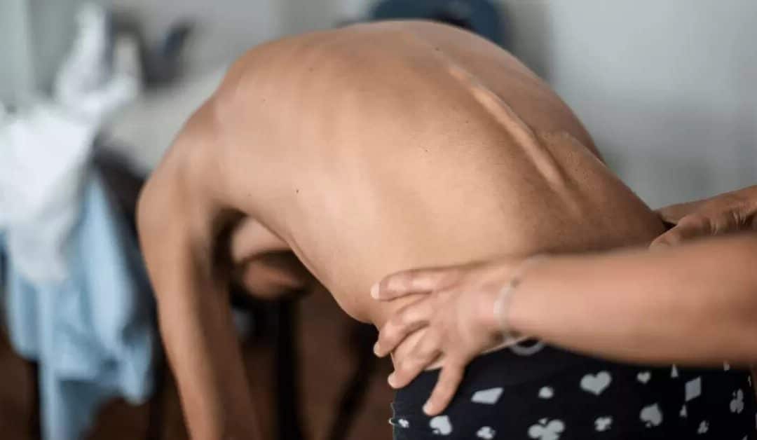 Schedule Your Scoliosis Assessment Today: Find Relief and Support at Winter Park Chiropractic