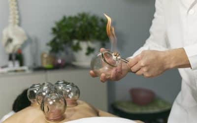 Discover the Path to Wellness with Chinese Cups Therapy in Orlando
